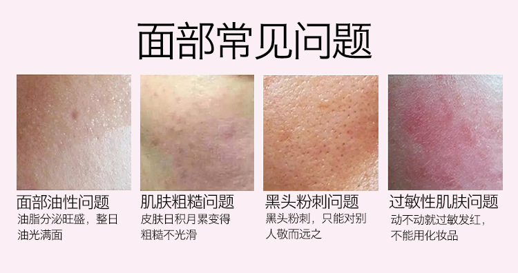 硅膠洗臉刷,硅膠章魚洗臉刷,硅膠潔面刷,硅膠洗臉神器 硅膠洗臉刷,硅膠章魚洗臉刷,硅膠潔面刷,硅膠洗臉神器